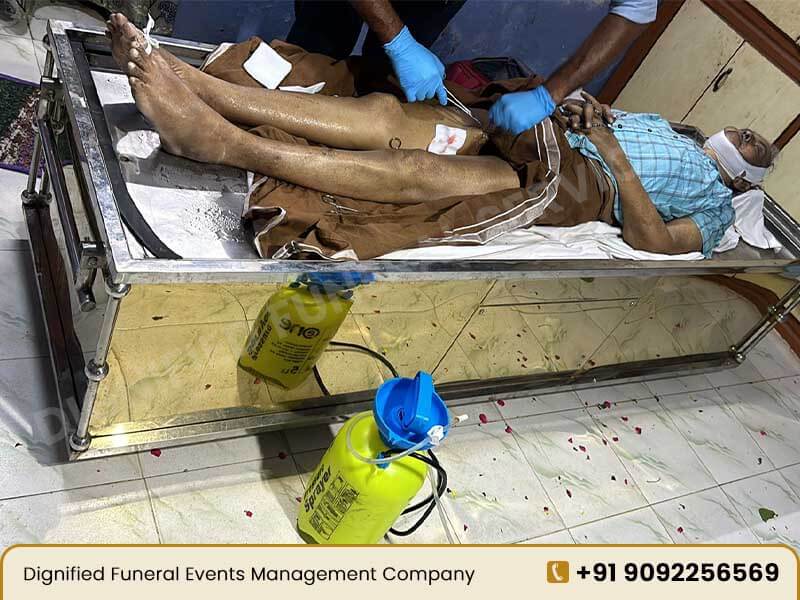 Embalming Services in Coimbatore