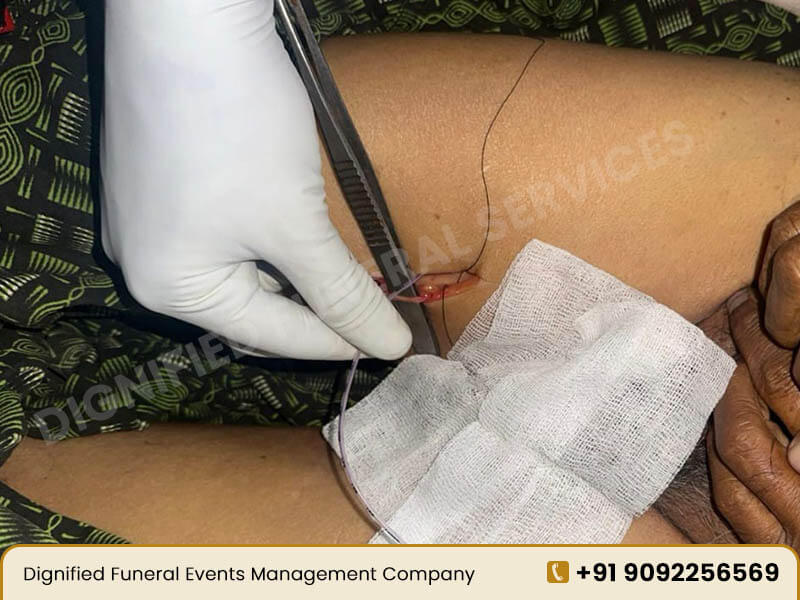 Human Body Embalming Services