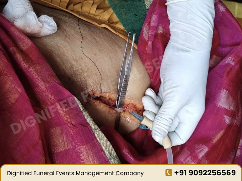 Professional Embalming Services in Coimbatore